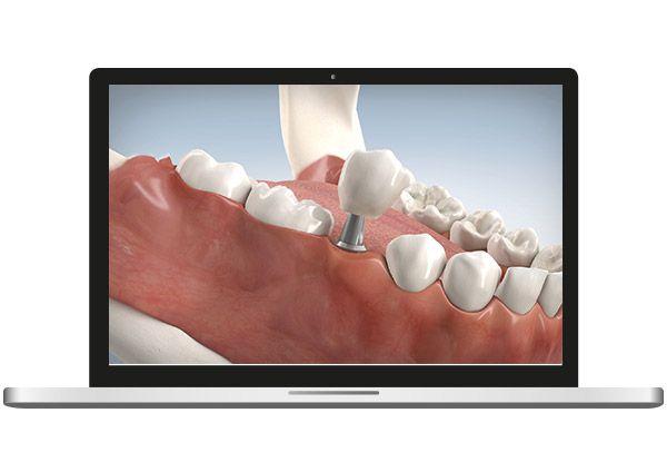 November 2017 – Smile-3D – so anschaulich war Beratung noch nie!